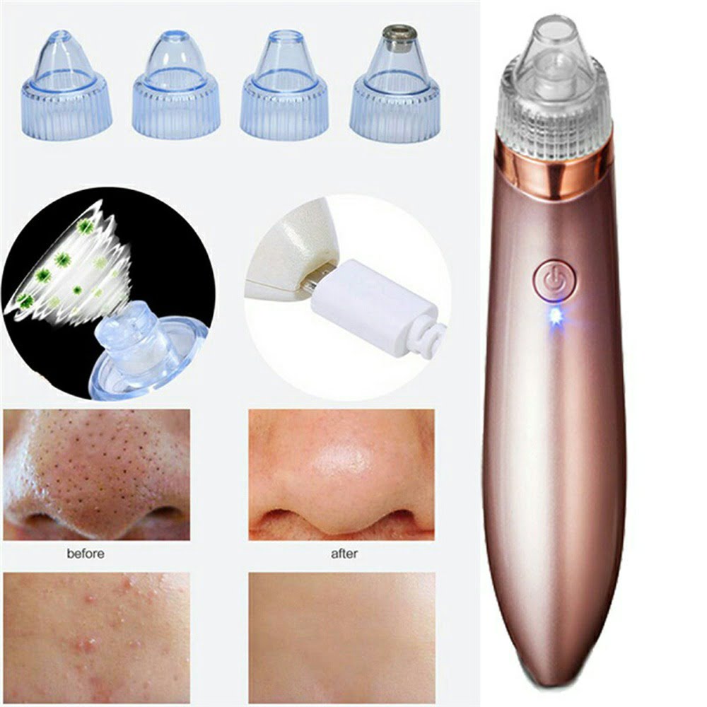 Blackhead Remover Face Acne Black Dot Pimple Electric Black Head Vacuum Cleaner Pore Skin Care Tools Machine 4 Replacement Head (random Color) - Image 7