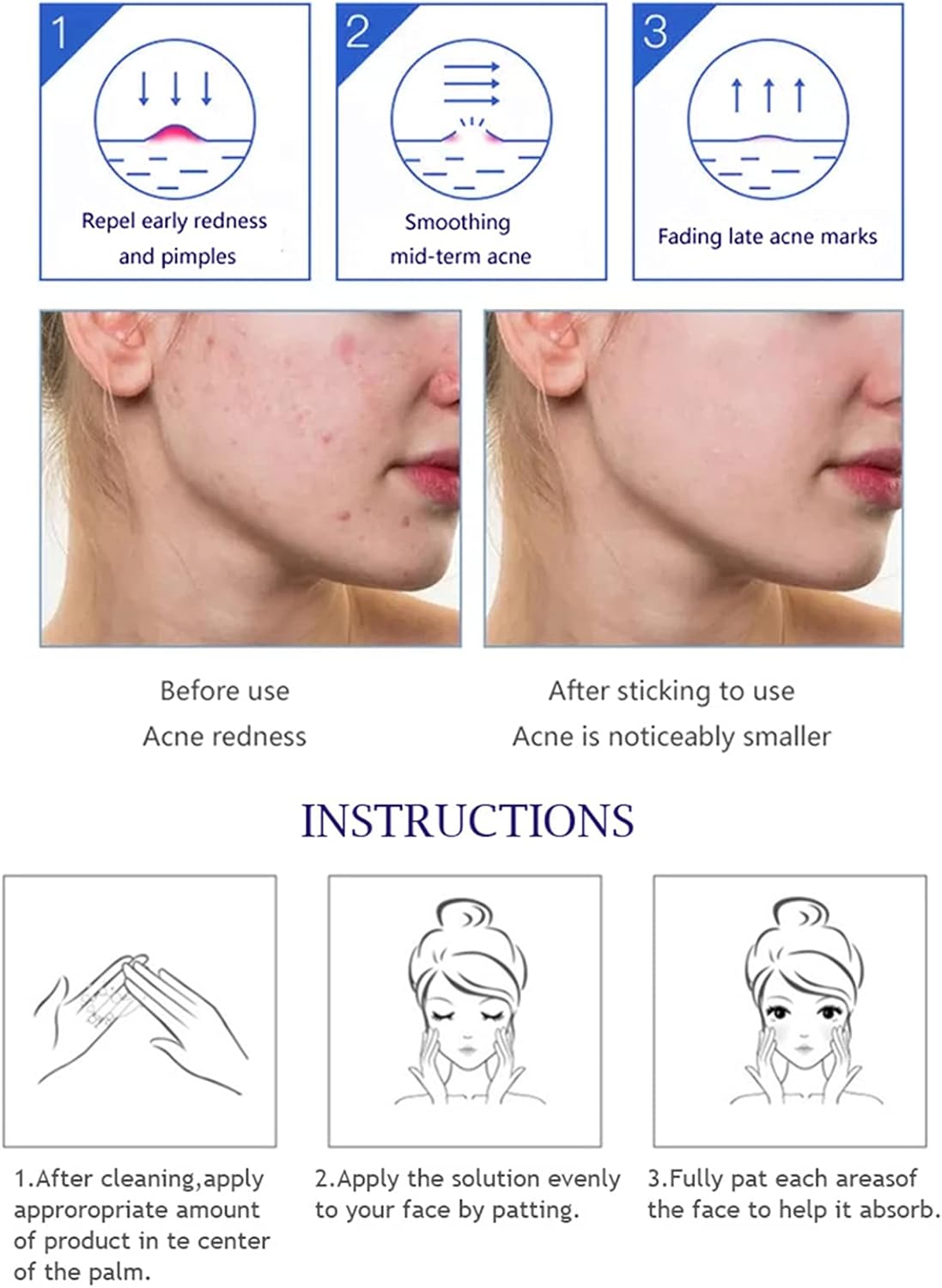 Aichun Beauty Anti - Acne Whitening Facial Serum Aloe Vera Extract Salicylic Acid Repairs Damaged Skin | 30ml - Image 5