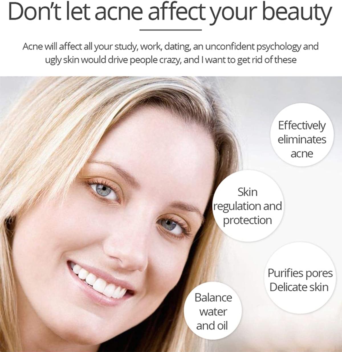 Aichun Beauty Anti - Acne Whitening Facial Serum Aloe Vera Extract Salicylic Acid Repairs Damaged Skin | 30ml - Image 7